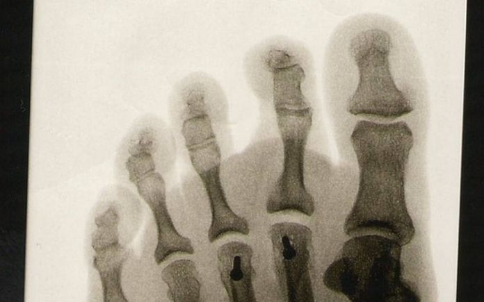 X-Ray Scanner Prank Apk Android